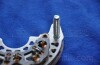Діодний міст Chevrolet Aveo PARTS-MALL PXPCC-002 (фото 5)
